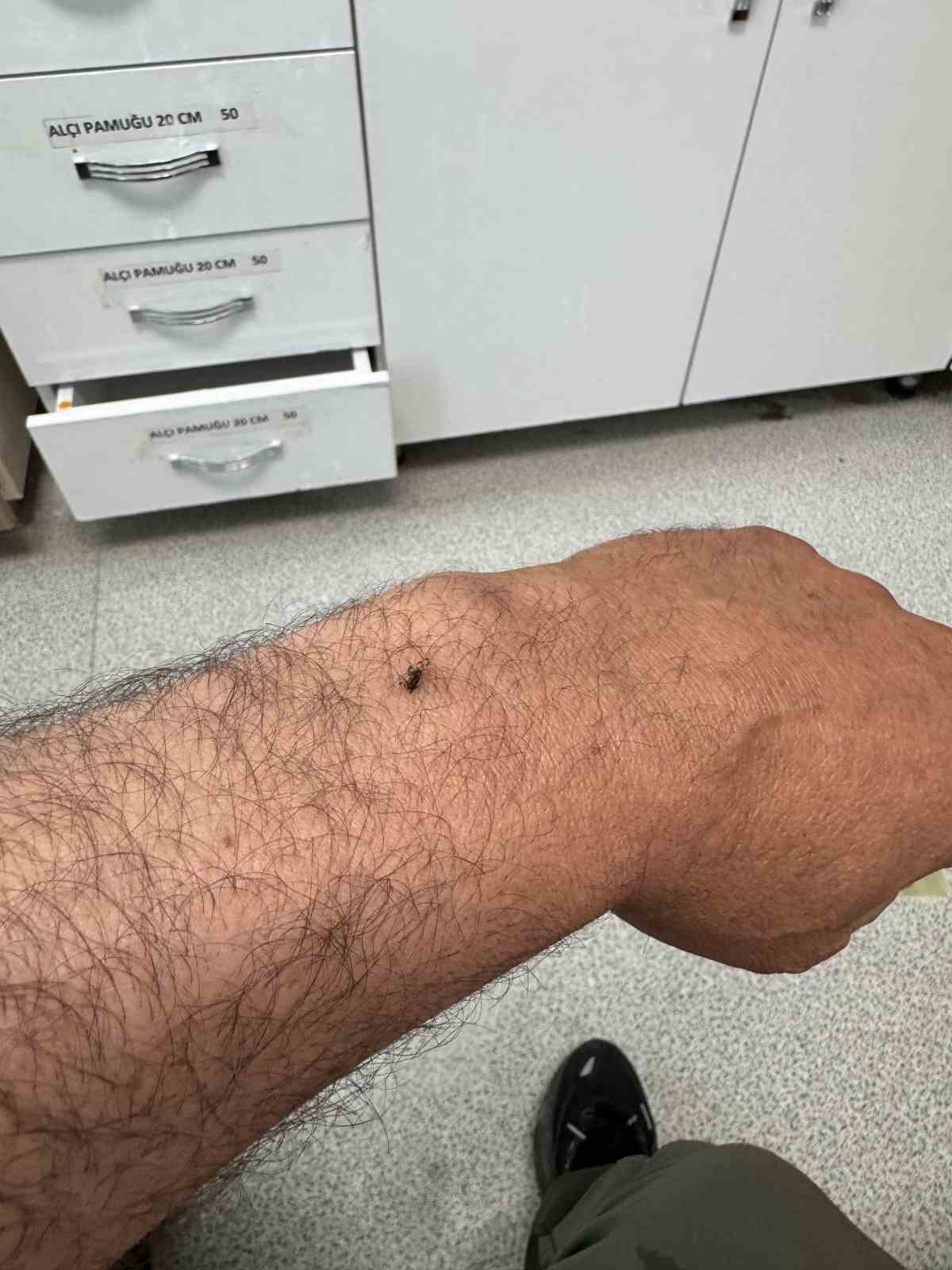 İtfaiye erinin koluna yapışan kene hastanede &ccedil;ıkarıldı